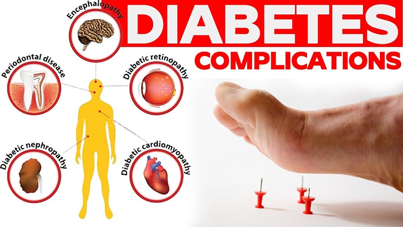عوارض و بیماری های ناشی از دیابت