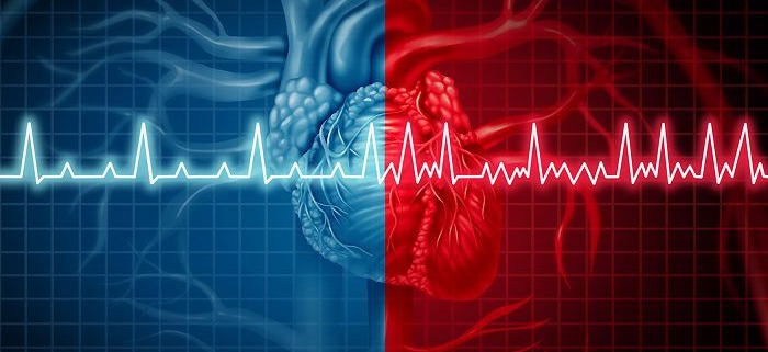 اختلال ریتم قلب (اصول الکتروفیزیولوژی، برادی آریتمی ها و تاکی آریتمی ها)