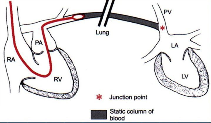 فشار ستون خون (static column of blood)