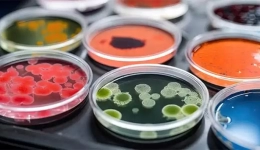 آزمایشگاه میکروب شناسی مواد غذایی